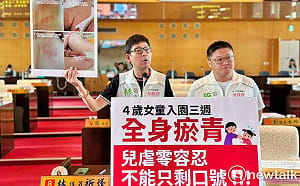 （影）4歲女童幼兒園遭虐全身傷   林祈烽痛批中市府通報牛步