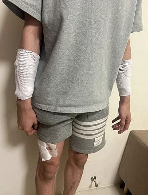 苗栗護理師遭隨機砍傷是假的！警方調查大逆轉 自導自演想「討拍」