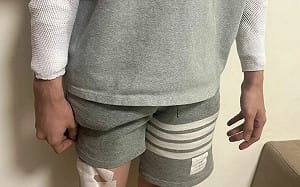 苗栗護理師遭隨機砍傷是假的！警方調查大逆轉 自導自演想「討拍」