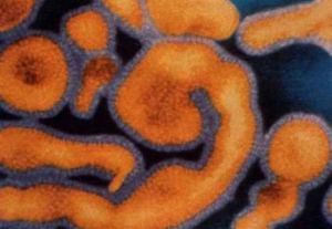 李氏桿菌病奪36命 南非採緊急措施