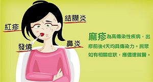 麻疹疫情擴大  疾管署：2978人自主健康管理