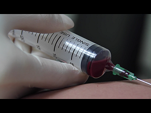 傳出院內麻疹感染  林口長庚成立因應小組  監控疫情