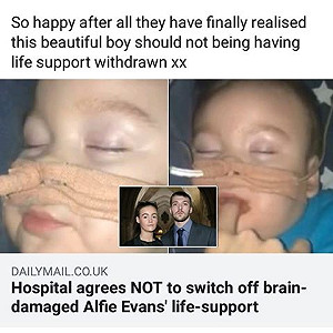 醫院關閉維生系統 英國末期罕病幼童奇蹟存活