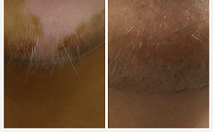 少年下巴長白鬍 擺「周董POSE」遮掩