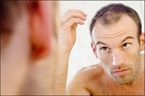 禿頭救星? 日研發毛囊製造技術 20天培養萬根髮