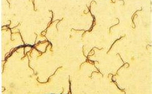 菲國細螺旋體病例破千 99人死亡情況恐惡化