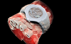 上帝粒子最新癌症檢查應用！3D彩色立體X光片顯像一清二楚