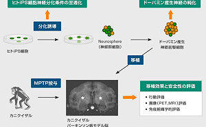 帕金森氏症有救星？日本擬iPS細胞治療創全球首例