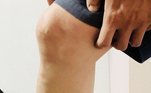 選購膝蓋保健食品 專家：仔細觀察成分別被誤導