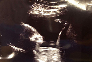 立委洪慈庸有孕了！和卓冠廷在臉書同時冠名宣布喜訊