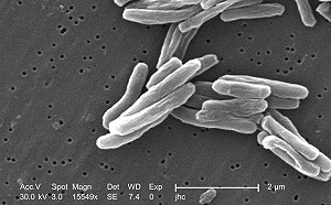 新藥物問世 結核病長期抗戰出現轉機
