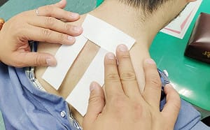 鼻過敏阻塞呼吸好難受  中醫穴位敷貼治療可改善