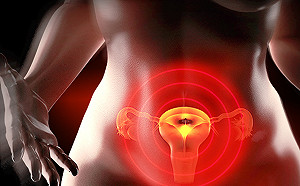 婦科第一瘤阻好孕　子宮肌瘤讓她血崩反覆流產