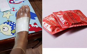 腳受傷套保險套防水又實用　網笑翻：有顆粒才止滑