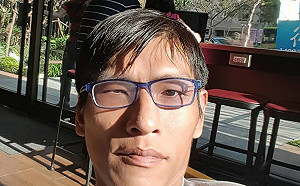 哀！台灣第一對成功分割連體嬰兄弟 哥哥張忠仁驟逝