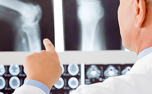 超音波篩檢骨密度　與DXA檢測結果接近