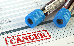 透過血液篩檢　精準預測頭頸癌轉移風險