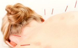 東方針灸　可緩解更年期不適