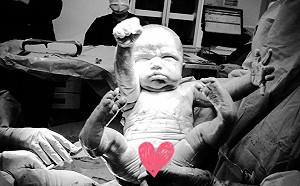 新生寶寶擺「超人POSE」出世　母笑：小超人誕生了