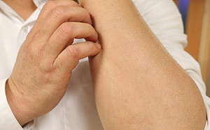 豪雨過後哈啾、紅腫樣樣來！這四個部位最容易引起過敏