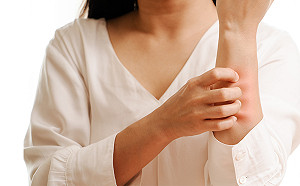 皮膚發炎癢透透　中醫治療首重溼氣排除