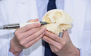 影／非拔不可　阻生智齒躲在左眼下險毀容