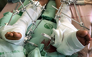 國三生疑遭霸凌跳樓輕生   校長今鞠躬道歉