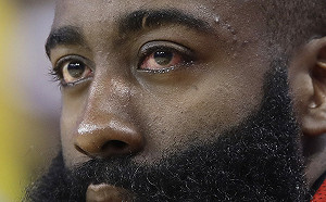 NBA／火箭好消息！哈登眼角膜沒事　關鍵第三戰能上(影)