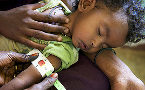 UN：近東北非5200萬人營養不良  1/5兒童過矮