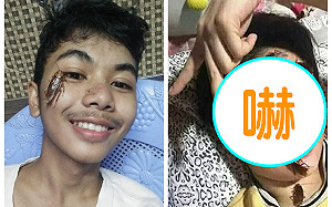 你敢嗎？超瘋狂「小強挑戰」爬滿臉　親友逃竄：別tag我