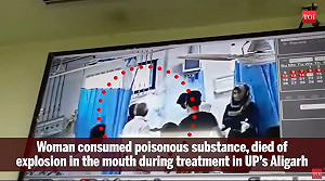 離奇醫療意外！印度女病患手術中 嘴冒白煙爆頭身亡