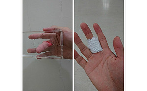 全台首例！男手指卡機殼滲血　他呼籲「千萬別買硬殼」