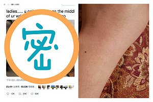 謎樣巧合？女生「這裡都有痣」　6萬人一看嚇瘋：我也是