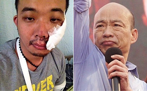 屢遭韓粉霸凌污辱 廣德家老闆PO受傷舊照嘆「內心傷害更多」