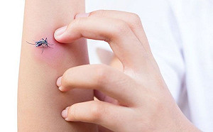 自製「中藥防蚊包」驅蚊又能醒腦！2種人不宜長時間使用