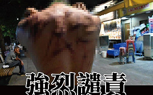 元朗白衣人狂毆民眾 民陣質疑「強力部門」動用暗黑勢力介入