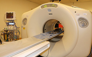 感冒、喉嚨痛竟照CT疑濫用檢查！健保署：地區醫院最誇張