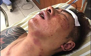 直播主遭擄斷手腳恐截肢 潘孟安宣示「掃黑」