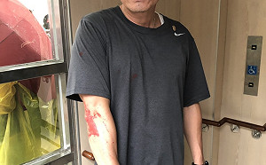 統促黨穿「反送中服裝」偷襲潑漆何韻詩 警方成立專案追主謀