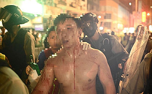 反禁蒙面法》香港1013混戰73送醫 首宗「不反對」集會今晚登場