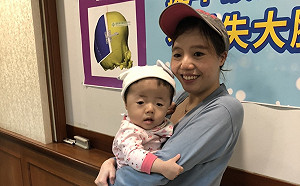 爸媽要當心！寶寶頭型怪怪？醫師：當心顱縫早閉症