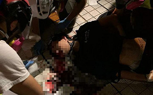 反送中傷亡頻傳 15歲少年頭部中催淚彈危殆、荃灣有黑衣人墜樓亡