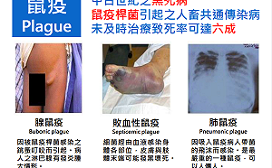 中國鼠疫3種類型全出現！疾管署：去這7個地區要當心