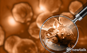 癌症治療大突破！國衛院找出癌細胞轉移關鍵