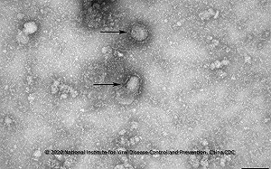 武漢肺炎》又是「蝙蝠」惹的禍？ 中國研究新型冠狀病毒與SARS「同宗」