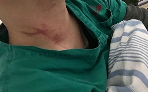 武漢肺炎》狼性?武漢醫院醫生遭患者家屬毆打 警方介入調查