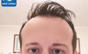 （影）義大利市長崩潰大喊 「病毒就是這樣傳播的！」