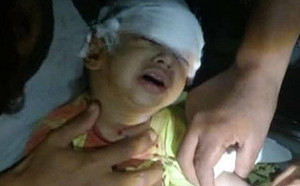 這世界還有神嗎?  幾百萬難民陷內戰營養不良  「中東最窮」葉門通報首起肺炎確診