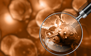 瑞士團隊研發病毒感測器 檢測空氣中的肺炎病毒