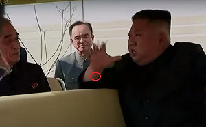 金正恩右手腕內側有疤痕  專家:應是心血管手術